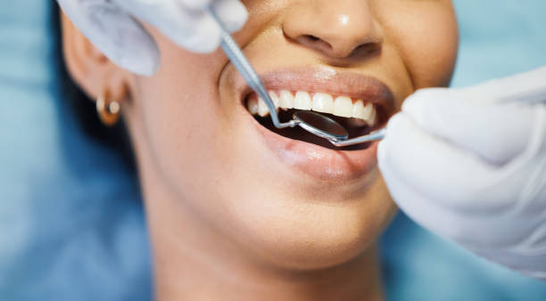 Best Emergency Dental Services for Seniors in Homosassa, FL