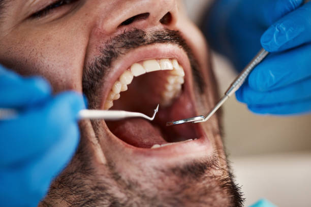Best Mobile Emergency Dentist in Homosassa, FL